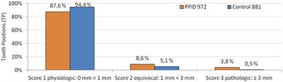 The Gingiva of Horses With Pituitary Pars Intermedia Dysfunction: A Macroscopic Anatomical Evaluation